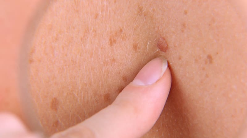 <div class="migrated-promo-image__description"><div class="migrated-promo-image__source">Fuente: Archivo</div></div>