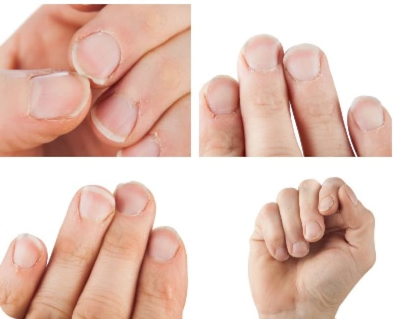 Las uñas pueden revelar importantes datos sobre tu salud.Foto: archivo