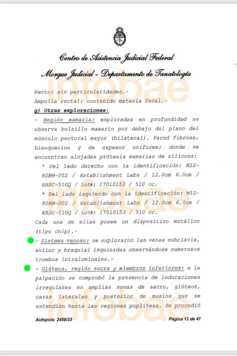 Autopsia de Silvina Luna. Fuente: Infobae.