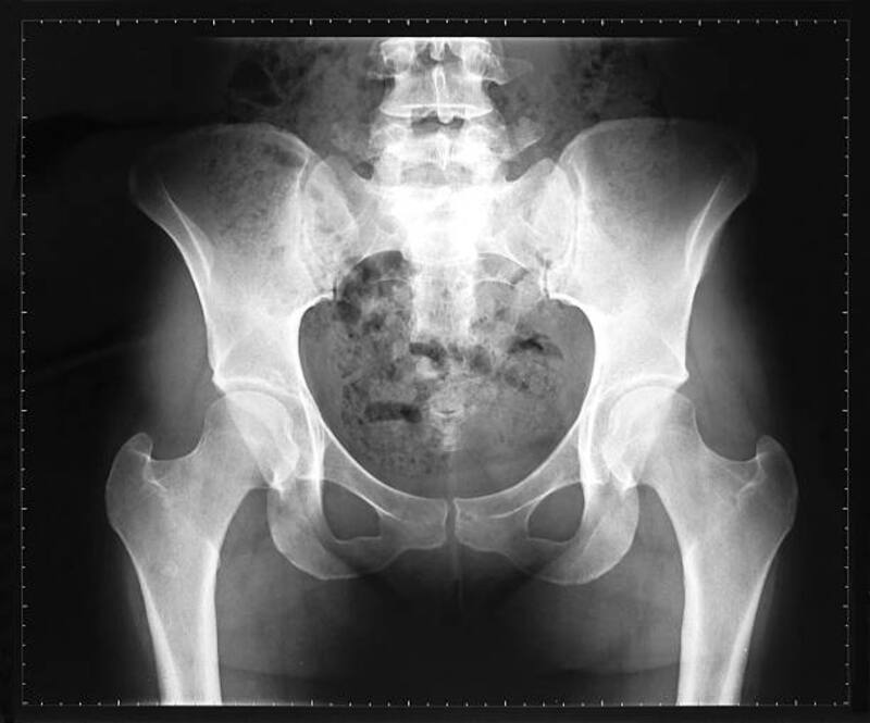 El coxis terminó siendo fundamental en la evolución genética de los humanos y los simios (Fuente: iStock)