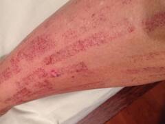 Adiós depilación definitiva: ANMAT prohibió esta marca y la quita del mercado