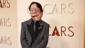 Lo que dejaron los Oscar 2026: ¿por qué Adam Pearson fue tendencia en Argentina?