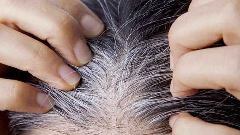 Adiós a las canas para siempre: la mezcla casera libre de tinturas y químicos para cubrirlas en un día. Fuente: Shutterstock.