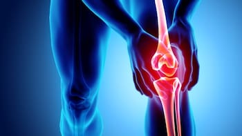 Cómo eliminar el dolor de rodilla para siempre: el ejercicio ideal para fortalecer las articulaciones y reforzar los huesos sin medicamentos