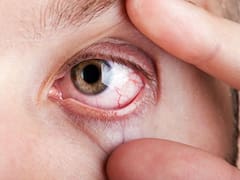 Adiós ojo seco: este es el superalimento que debes consumir todos los días para reducir la irritación