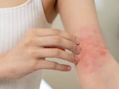 El estrés da dermatitis: por qué los científicos advierten que tu piel puede empeorar bajo presión y qué ocurre en el cuerpo