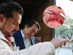 Detectaron algo en las escuelas que afecta a más de 9.2 millones de niñas y niños y el gobierno tuvo que intervenir de inmediato