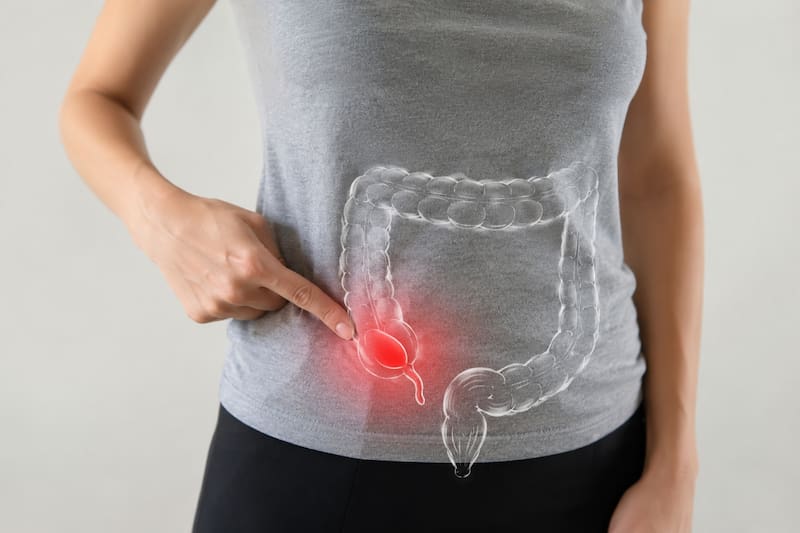 Aunque sigue sin ser un órgano indispensable para vivir, los investigadores sostienen que el apéndice tendría un papel importante en la microbiota intestinal. (Imagen ilustrativa creada con IA)