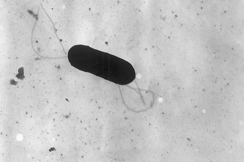 Esta bacteria puede causar infecciones graves y se desarrolla incluso a temperaturas de refrigeración, lo que la hace especialmente peligrosa en alimentos listos para consumir.