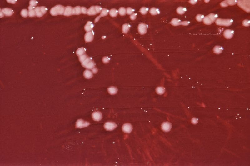 La bacteria Pseudomonas aeruginosa puede afectar especialmente a personas vulnerables si se consume en productos contaminados