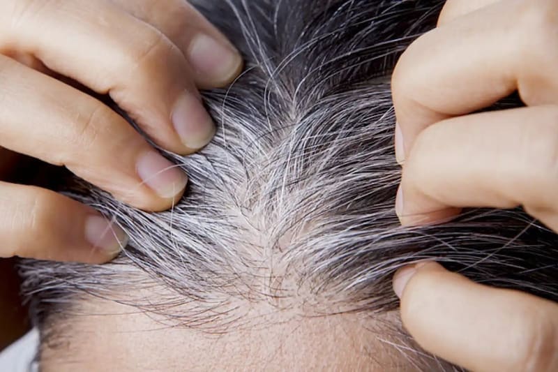 Fin de las canas para siempre: el tinte casero y libre de químicos que las oculta naturalmente