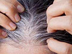 No es por la edad: expertos revelaron por qué nos salen canas y está podría ser la única cura