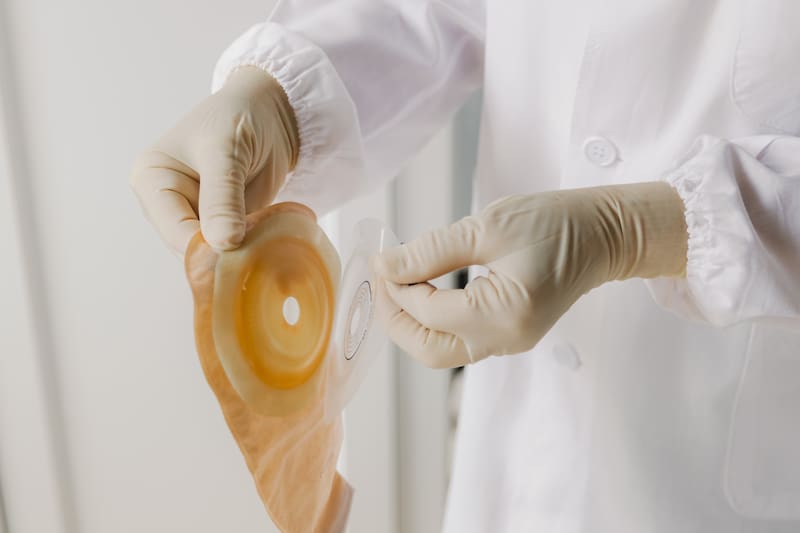 PAMI: guía paso a paso para solicitar las bolsas y discos de colostomía, ileostomía y urostomía