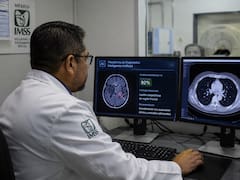 Cambia el IMSS para siempre y ya no será igual para todos los beneficiarios: comenzarán a usar inteligencia artificial para los diagnósticos