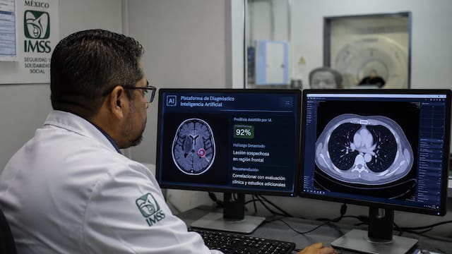 Cambia el IMSS para siempre y ya no será igual para todos los beneficiarios: comenzarán a usar inteligencia artificial para los diagnósticos