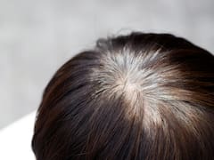 Se terminaron las canas para siempre: el método 100% orgánico y sin tintura que las erradica de raíz y brinda brillo instantáneo