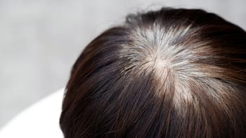 Se terminaron las canas para siempre: el método 100% orgánico y sin tintura que las erradica de raíz y brinda brillo instantáneo