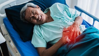 Cáncer de colon: este es el primer síntoma que nadie le da importancia, pero es clave para detectar la enfermedad