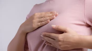 Un nuevo medicamento marca un hito en el tratamiento del Cáncer de Mama temprano