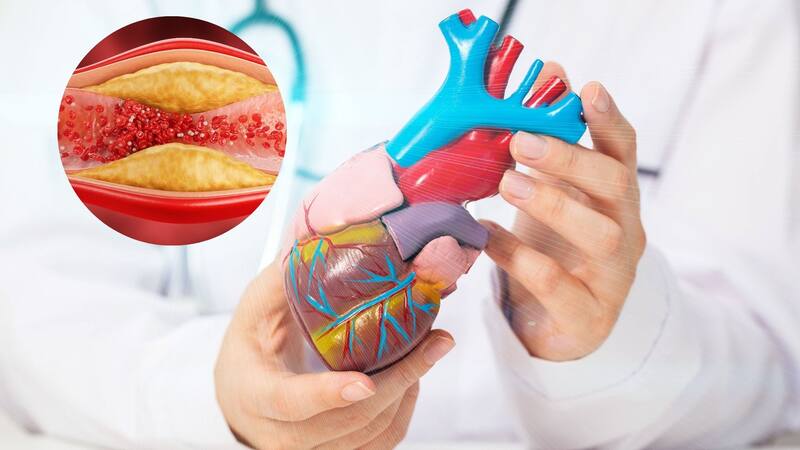 Colesterol alto | Cuántas nueces se recomienda consumir por día para disminuirlo