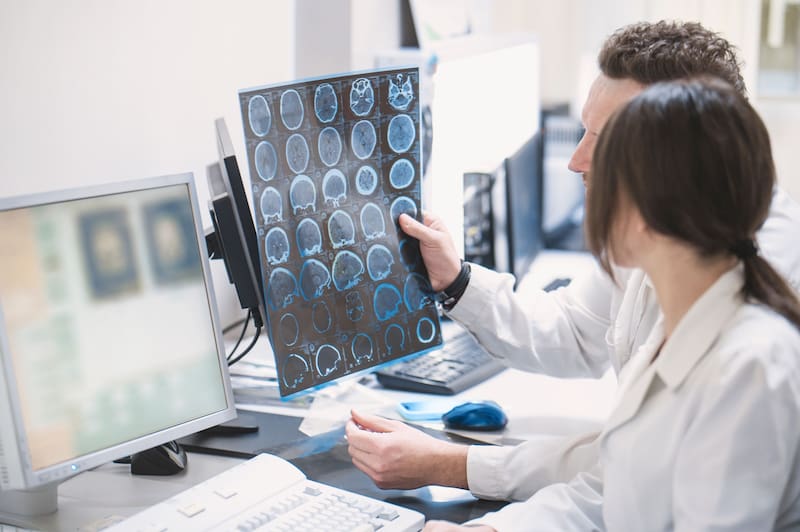 El cerebro no se desarrolla del mismo grupo celular, según el nuevo estudio de Standford.