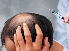 Eduardo López, dermatólogo: “En cinco años, podremos recuperar el pelo con una sola inyección”