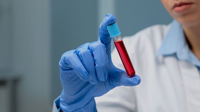 El estudio sobre un animal prehistórico que podría ayudar a tratar enfermedades sanguíneas como la leucemia. Foto: Freepik