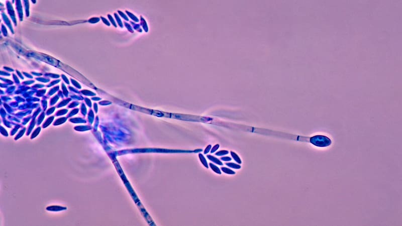 El hallazgo del siglo: encontraron una planta que puede producir oro y puede crecer en cualquier casa