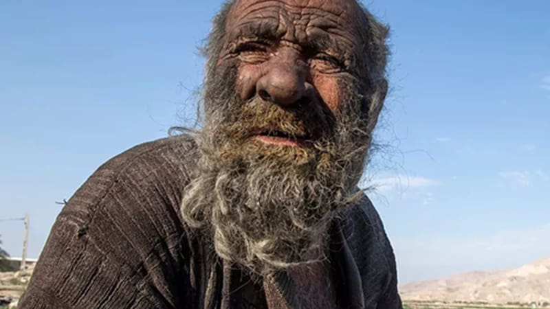 El hombre más sucio del mundo