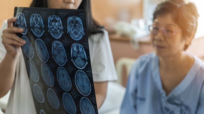 En Argentina se producen entre 120.000 y 130.000 accidentes cerebrovasculares (ACV) cada año