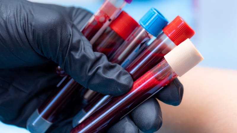 especialistas en medicina transfusional advirtieron que un número elevado de restricciones podría desalentar a potenciales donantes y afectar las reservas de los bancos de sangre.