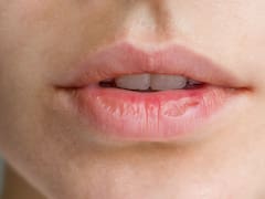 Se despiden los labios secos por el viento, calor o frío: remedios caseros naturales para hidratar y potenciar tu boca