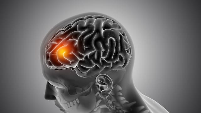 El hallazgo médico que sacude a la ciencia: la zona olvidada del cuerpo que nadie sospecha pero podría estar detrás del Alzheimer