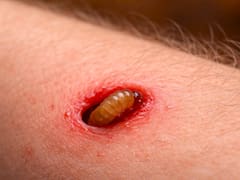 Alarma sanitaria | Una plaga erradicada hace seis décadas está regresando a Estados Unidos: se retuerce en la carne viva y se alimenta de ella