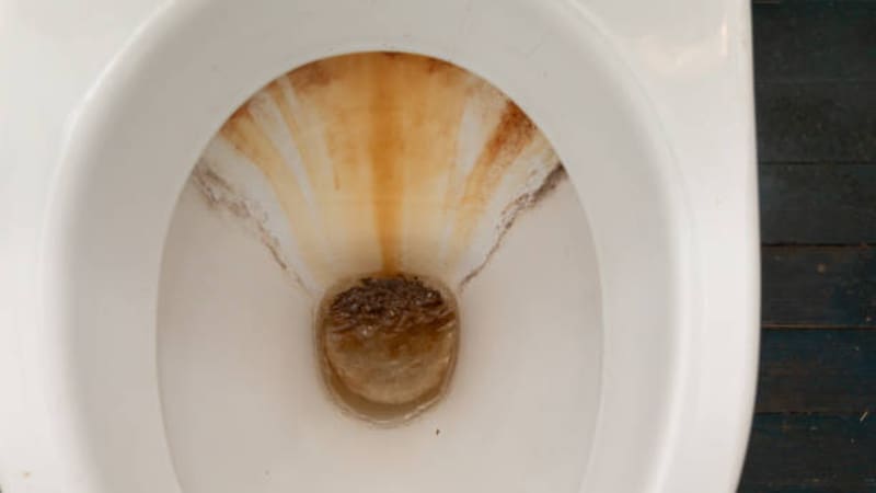 Este ingrediente casero es ideal para limpiar el sarro del inodoro. Fuente: Archivo.