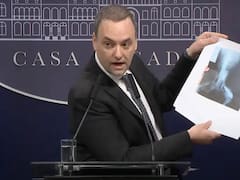 Cambia el Certificado Único de Discapacidad: cuándo se debe actualizarlo y qué condiciones hay que cumplir