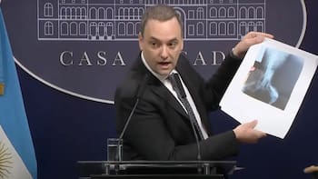 Cambia el Certificado Único de Discapacidad: cuándo se debe actualizarlo y qué condiciones hay que cumplir