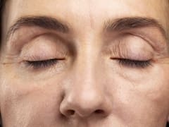 Adiós a las bolsas debajo de los ojos para siempre: el truco para erradicarlas con remedios naturales