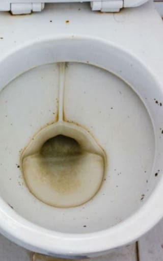Ni vinagre ni bicarbonato: el truco viral para quitar el sarro de las canillas y las manchas amarillentas del inodoro al instante