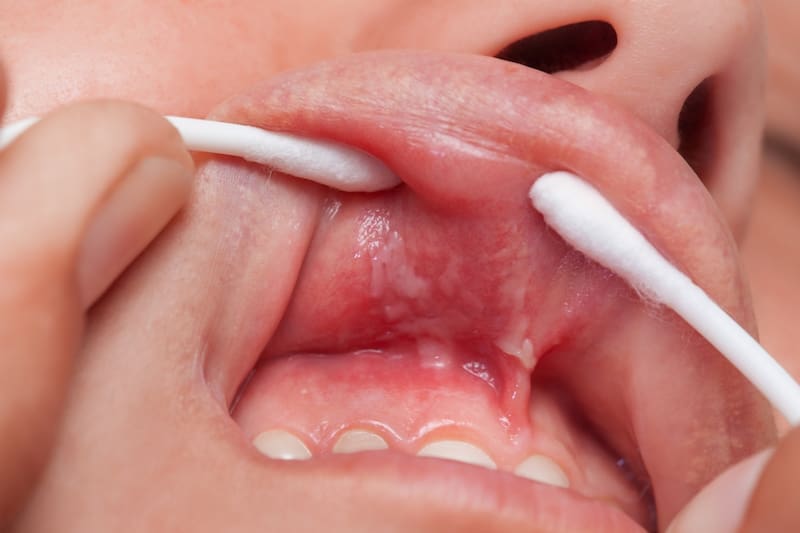 Ilustración de la salud bucal