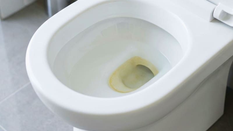 Ni lavandina ni detergente: la manera ideal de sacar el sarro del inodoro y evitar la pérdida de presión en la descarga.