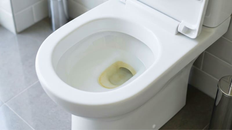 Ni lavandina ni detergente: la manera ideal de sacar el sarro del inodoro y evitar la pérdida de presión en la descarga.