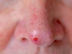 El enemigo silencioso que está acabando con los mexicanos: no es la sal ni el azúcar, es mucho peor