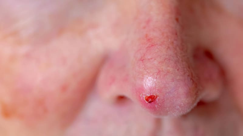 Daños en la piel: el impacto que no se ve hasta que es tarde.