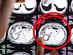 Confirmado por la ciencia | El cerebro puede regenerarse por sí mismo: el hábito que cualquiera puede hacer para cuidar la memoria y el aprendizaje