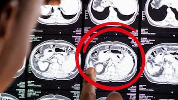 Confirmado por la ciencia | El cerebro puede regenerarse por sí mismo: el hábito que cualquiera puede hacer para cuidar la memoria y el aprendizaje