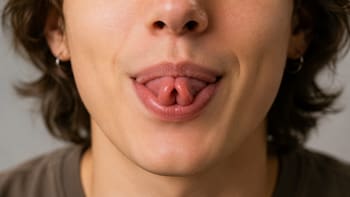 Qué representa para los psicólogos la capacidad de doblar la lengua “en taquito”: es mucho más que una simple destreza
