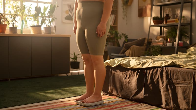 El lipedema afecta piernas y brazos, respetando siempre manos y pies.