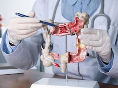 Harald zur Hausen, Nobel de Medicina, advirtió sobre el consumo de este alimento: “Es un factor de riesgo para el cáncer de colon”