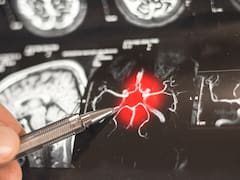 Alzheimer | Descubren una molécula que reprograma las defensas del cerebro y mejora la memoria